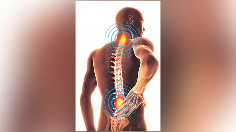 ডিস্ক প্রলেপস হলে কী করবেন...