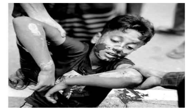 কুড়িগ্রামে সড়ক দুর্ঘটনায় ১০ বছরের শিশুর মৃত্যু...