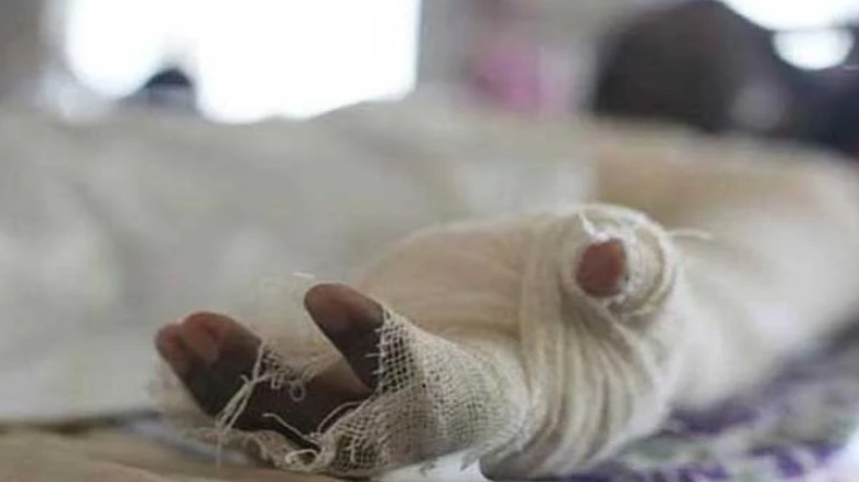 চমেক হাসপাতালে এসি বিস্ফোরণে তিন শ্রমিক দগ্ধ...