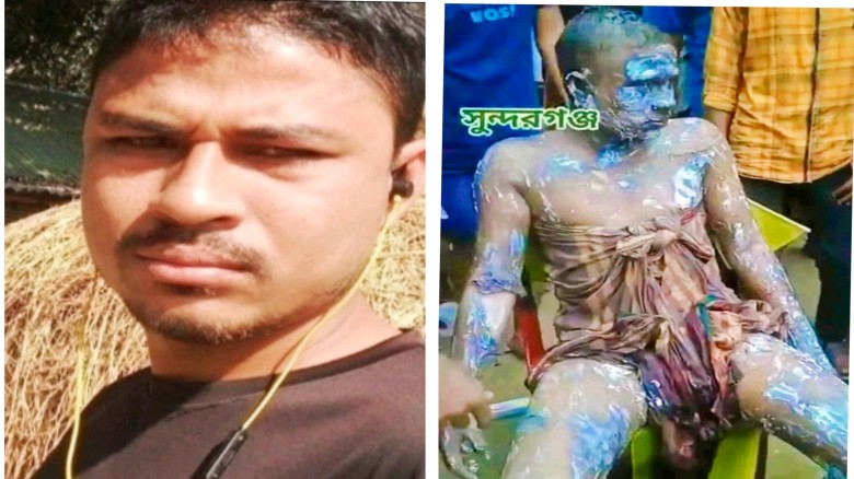 সুন্দরগঞ্জে শরীরে পেট্রোল ঢেলে আগুন দেওয়া সেই যুবক...